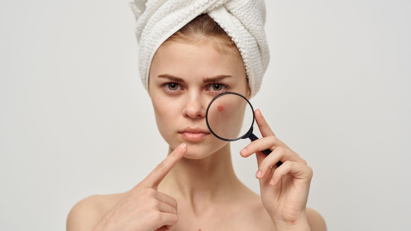 Skin Care for Acne and Dark Spots Helpful Tips